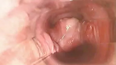 Muškarac jebi u porno filmovi medicinske sestre dupe porno transrodnost nakon posao udarac u usta